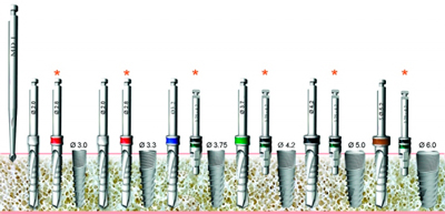 Схема использования цилиндрических сверл для имплантатов «Юниверсал»